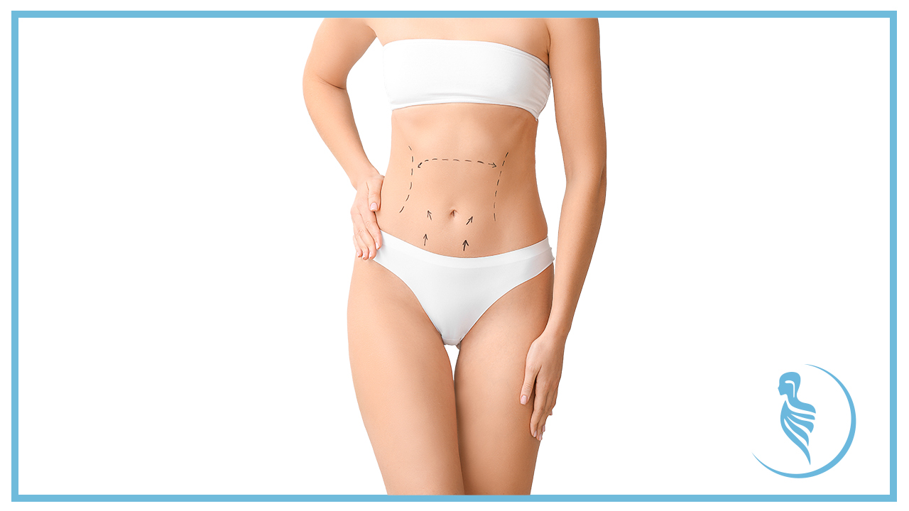 Abdominal Liposculpture